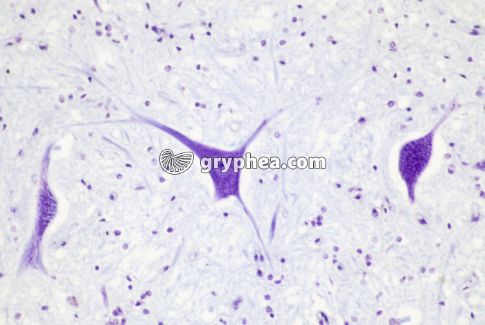 Neurone ME x100 - gryphea.org